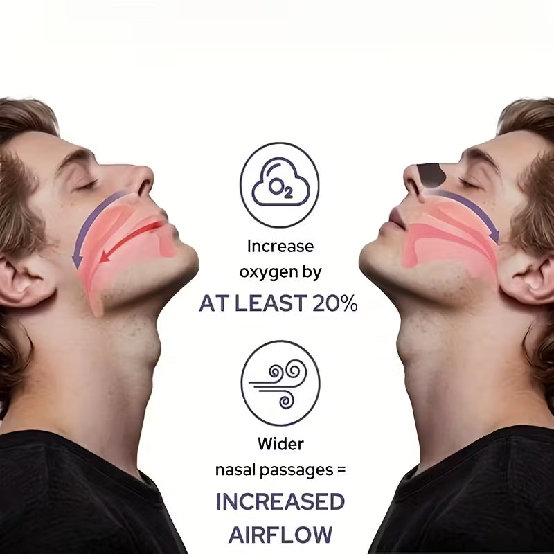 Nasal Strips